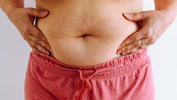 Does menopause cause gut issues? The research